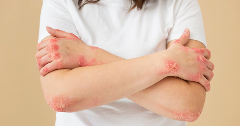 Gut-brain axis diagram showing connection between brain and digestive system